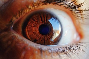 Picture Of Human Eye With Vision Loss